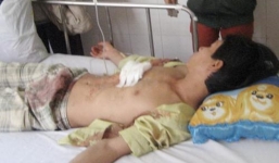 Bị đâm lòi ruột vì không cho mượn tiền